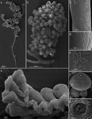   Zoothamnium！一探這奇妙的微生物世界，見證「水中的毛茸茸」